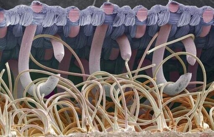 آنالیز تصاویر میکروسکوپی با نرم‌افزار clemex و image j